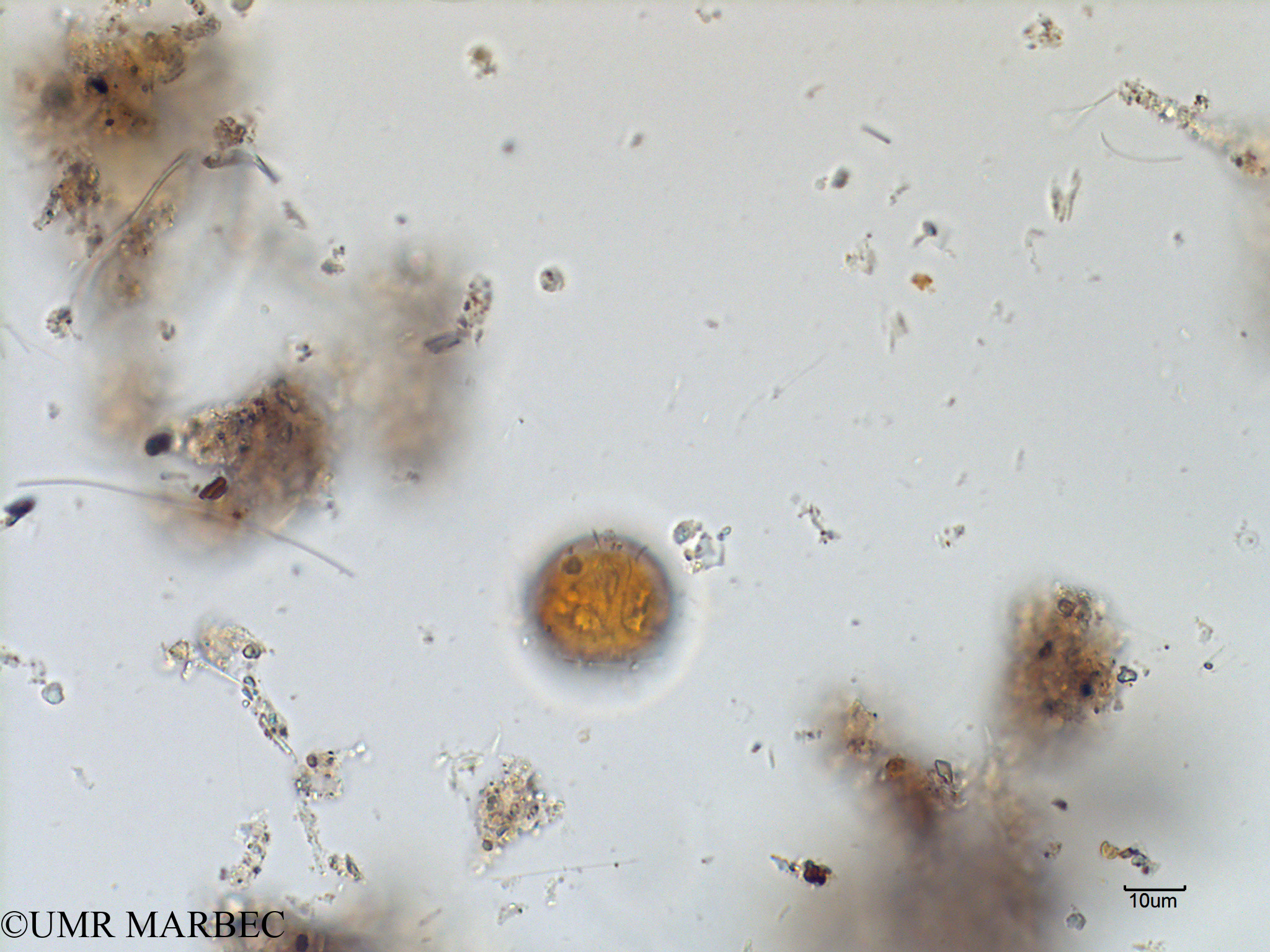 phyto/Scattered_Islands/mayotte_lagoon/SIREME May 2016/Protoperidinium sp42 (MAY4_proto lequel c-2).tif(copy).jpg